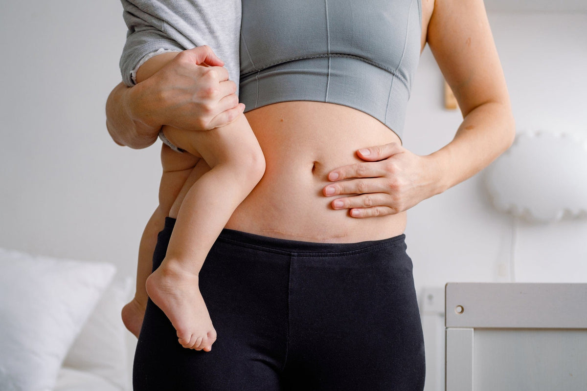 Babywearing After C-Section